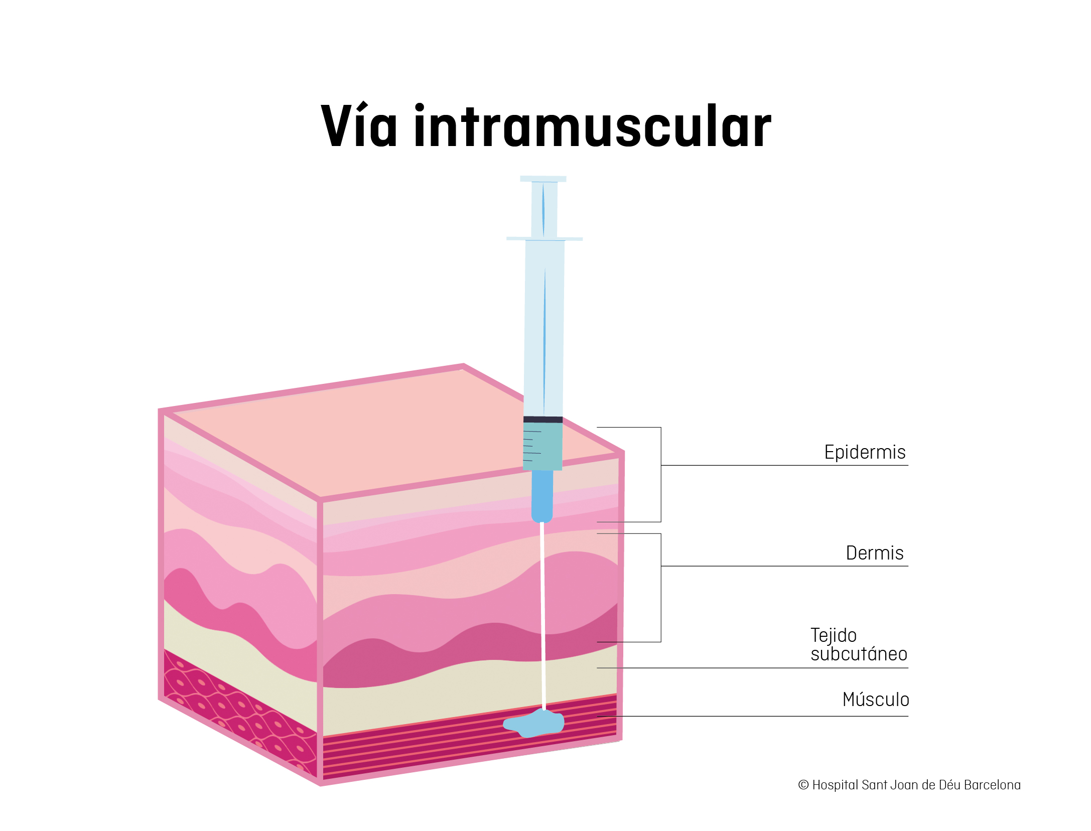 Vía intramuscular | Escola Salut SJD
